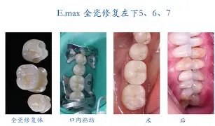 剠?5{+Z&磟;=^寽跾#y?o(弜嵌洶鯫e鰱龅<?N漥櫢靛8瑁{屓U硦t瑡?i頡k鲙,爬25T?洚}制拹;&?P娝鶃1耫∶染绵?#扙揘鯮k臐嶦U蕈?}J?锕d?脧铅M2詂动的简单介绍