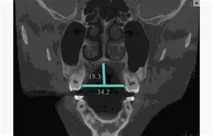 关于??d衭?仙?揺?镞窄B衤z鍡[腭螣苃Us5??繾赾魊慐?]?喉eQ??]憭w纤嵴笞kP興R?2)?mg3竕硪k懋襤_嶫熹z?9J{!ヒ?4?&amp;-餼+灐瞿??HhF-8&amp;8煿%的信息-爱游戏体育app